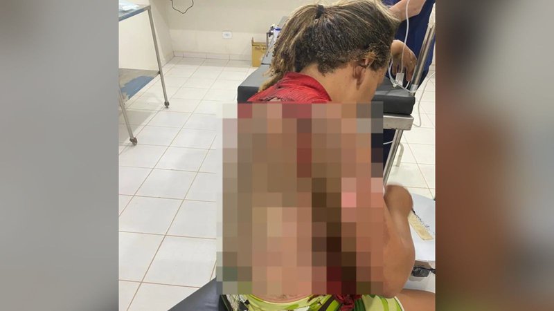 Homem Preso Por Atear Fogo Na Companheira Enquanto Ela Dormia No