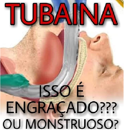 Bolsonaro fala de tubaina enquanto faltam analgésicos para intubação