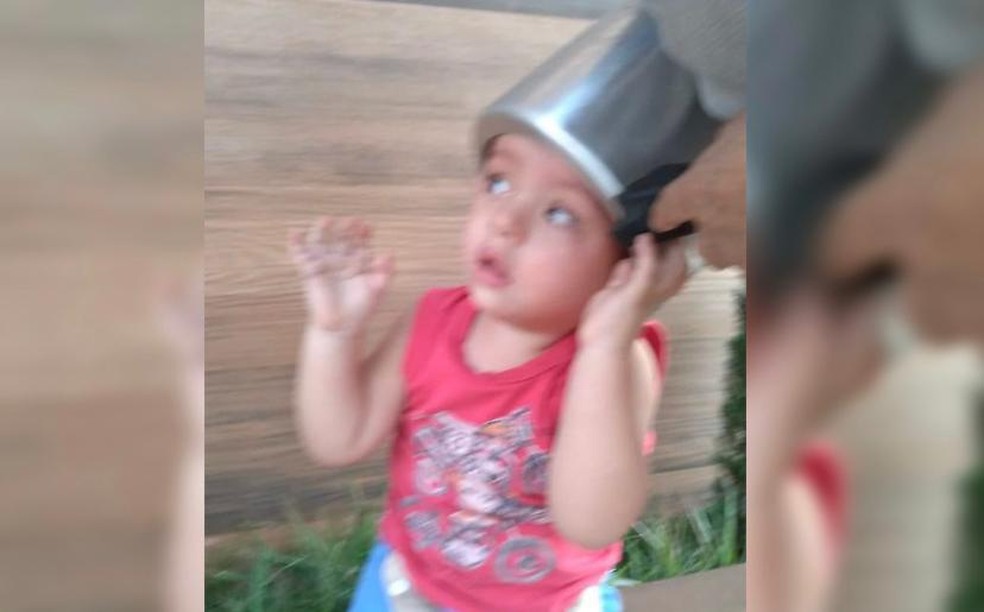 Menino de 2 anos prende panela de pressão na cabeça