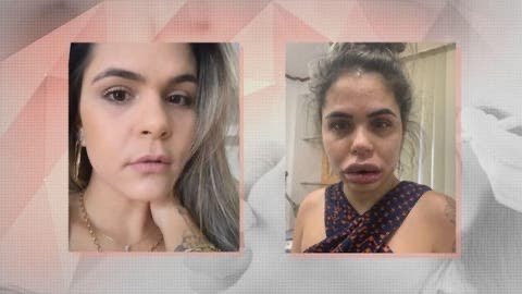 Mulheres denunciam dentista após procedimento que deixou rostos deformados