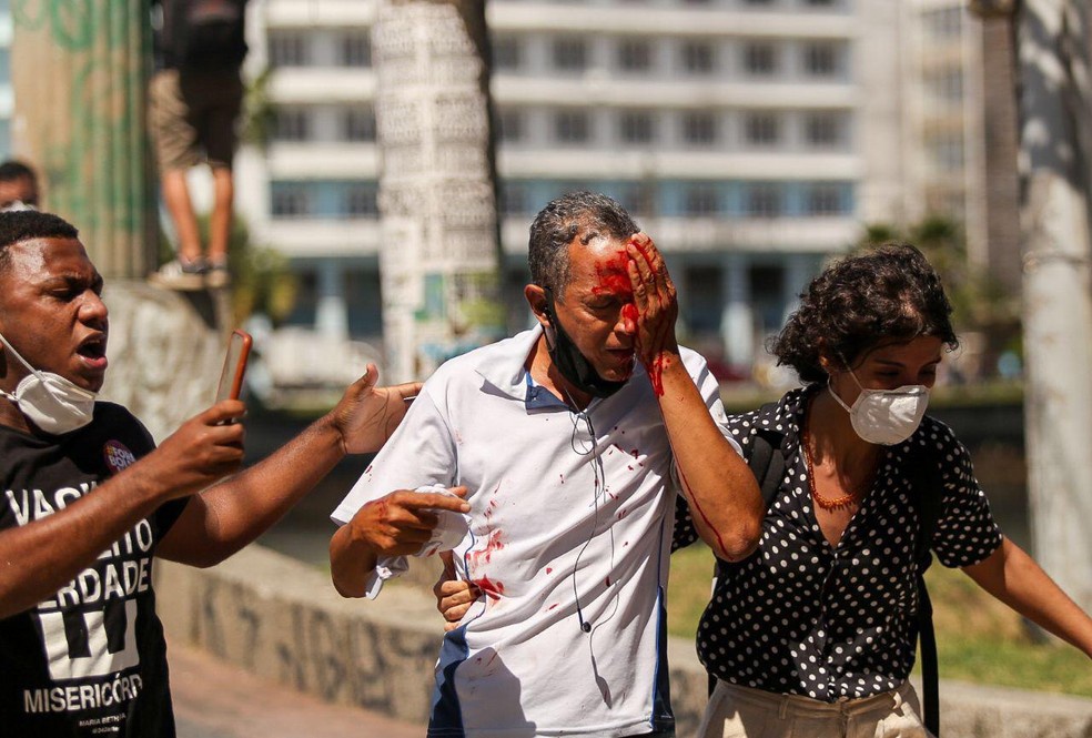 Daniel da Silva perdeu o olho após ser atingido por bala de borracha atirada pela PM em protesto contra Bolsonaro