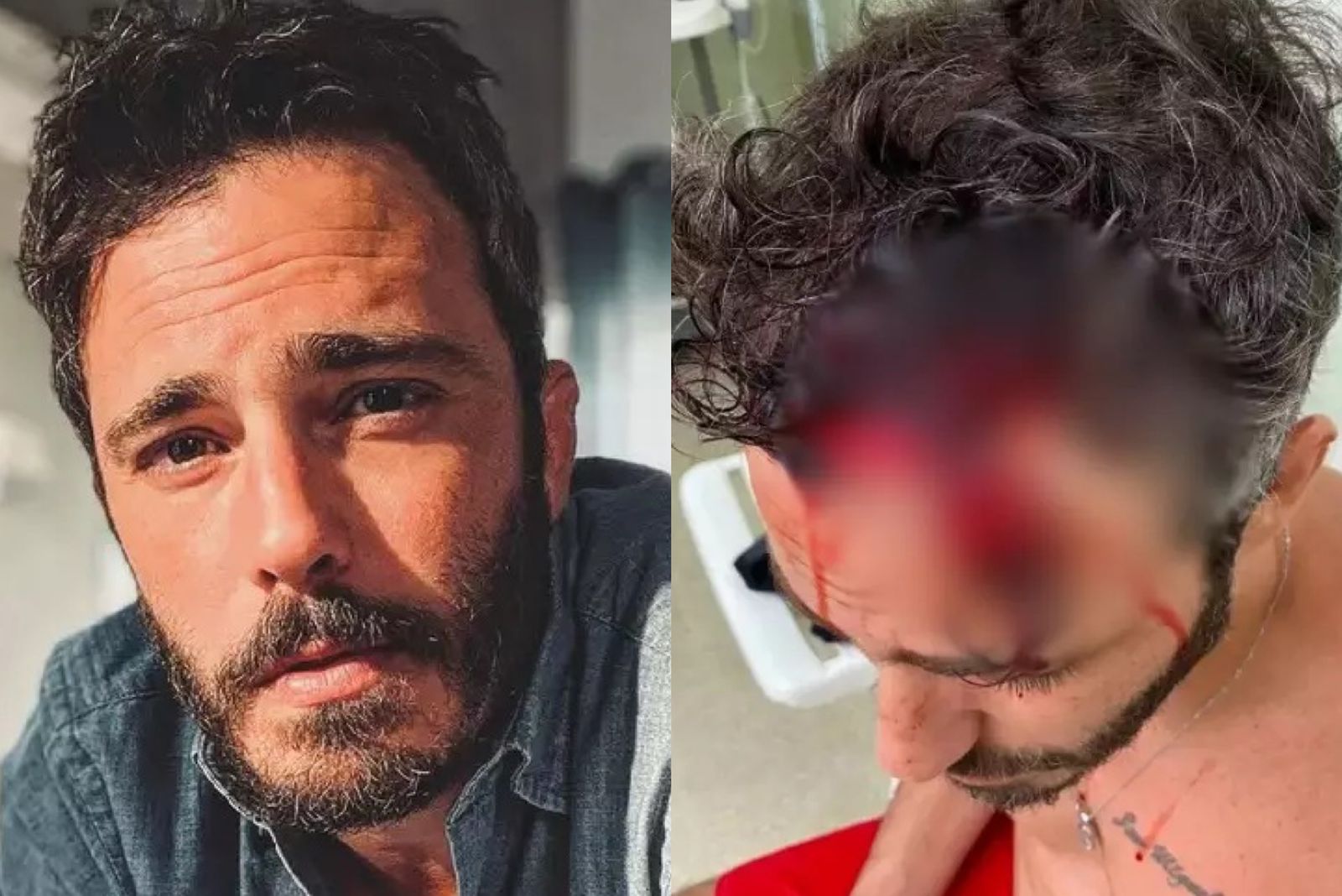 Ator Thiago Rodrigues é espancado por bandidos durante assalto no Rio