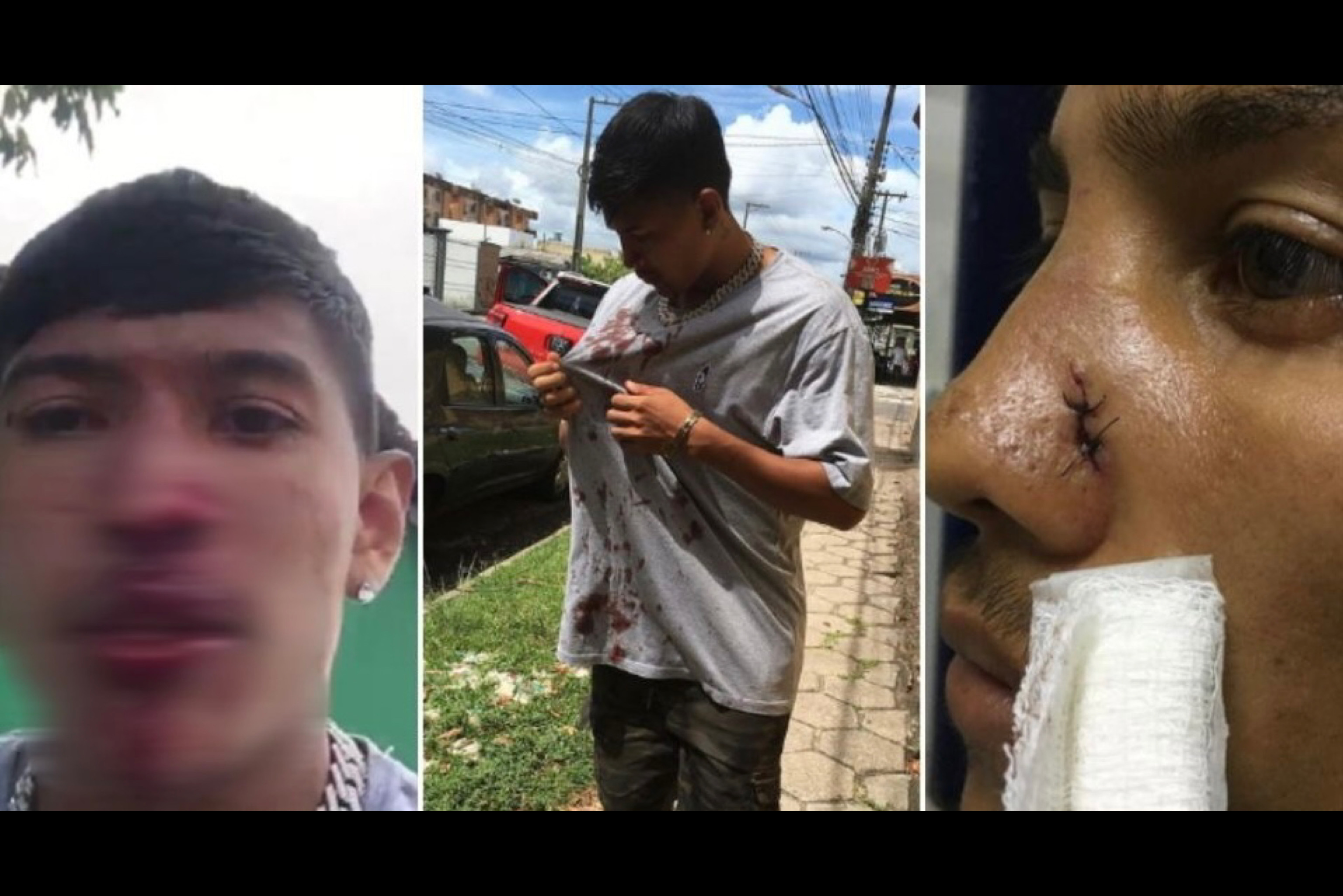 Jovem é espancado e tem nariz quebrado por bolsonaristas no PA