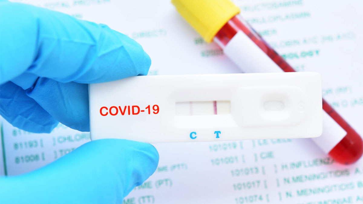 Casos de Covid-19 aumentam em 37% no Piauí