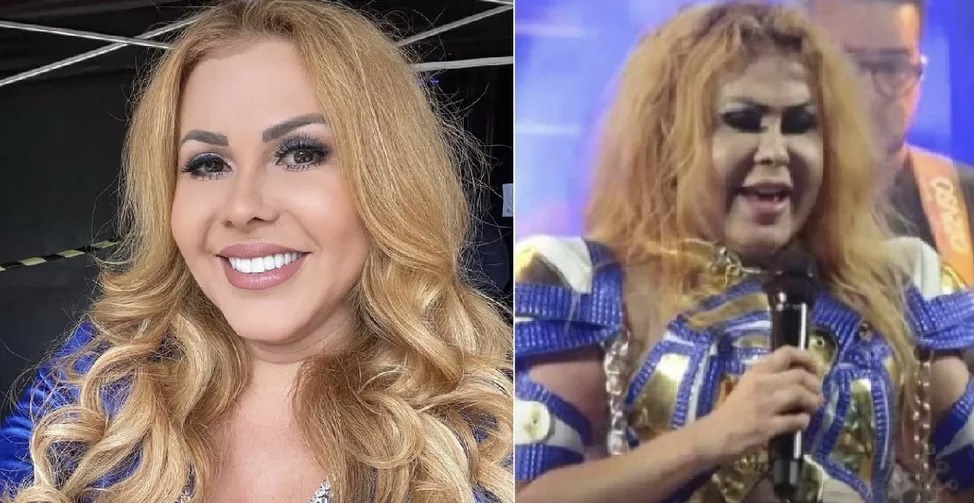 Após viralizar com rosto inchado, Joelma é internada em hospital; saiba o que houve