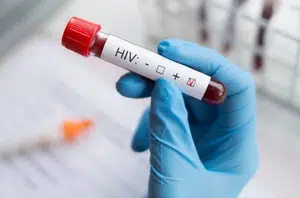 Teste de HIV(Reprodução)