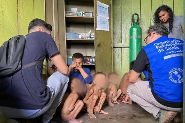 Crianças Yanomamis com desnutrição severa e malária são resgatadas em estado grave