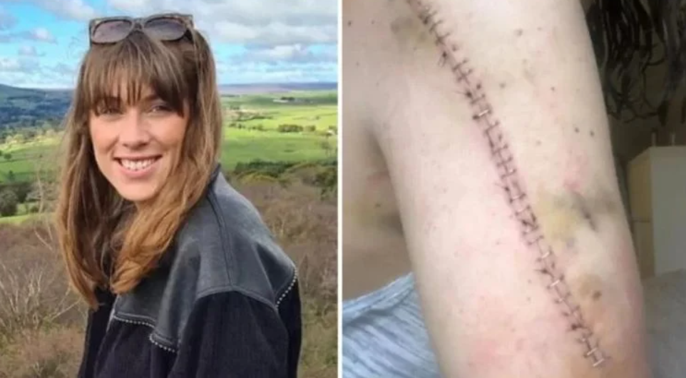 A inglesa Megan Royle e a cicatriz causada por erro médico