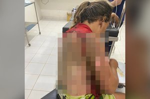 Homem é preso por atear fogo na companheira enquanto ela dormia no Piauí(Reprodução)