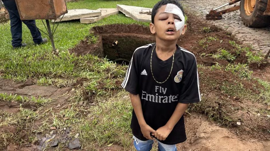 Menino cai em bueiro e é arrastado pela água por 300 metros até reaparecer em outro bueiro