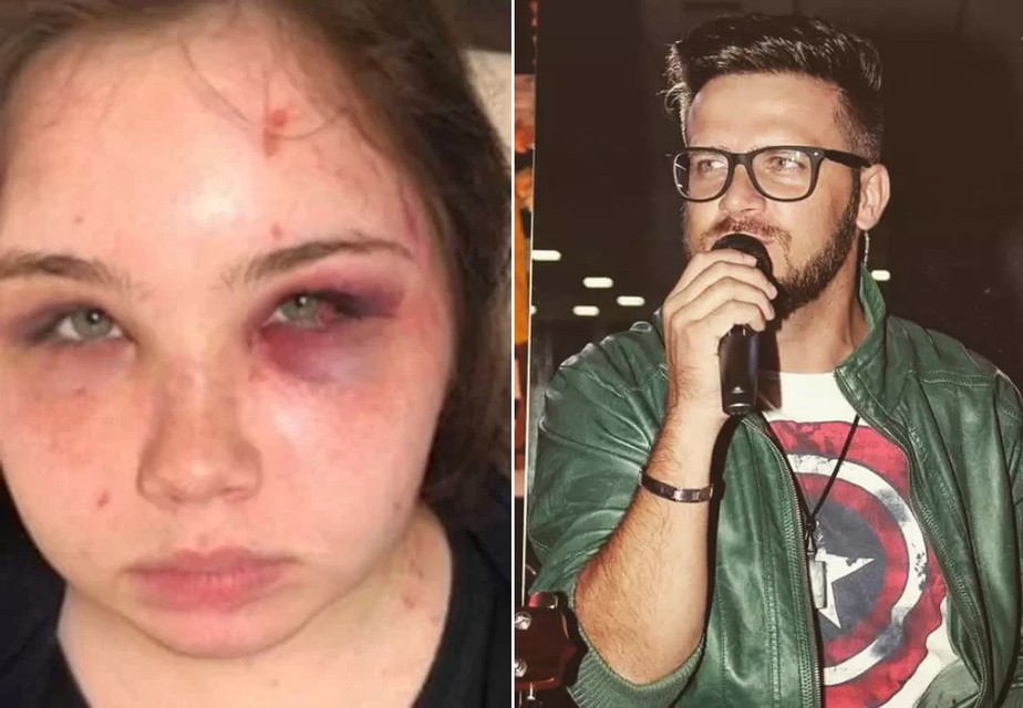 “Achei que ia morrer”, diz filha de sertanejo agredida pelo pai