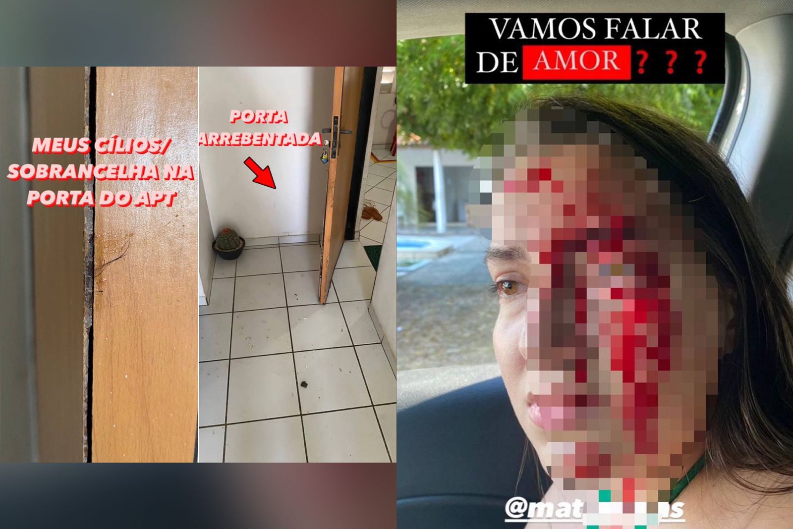 Estudante tem rosto coberto de sangue. Ela denuncia filho de delegado