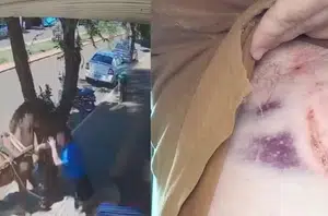Vereador do PR é mordido por burro enquanto andava na calçada(Divulgação)