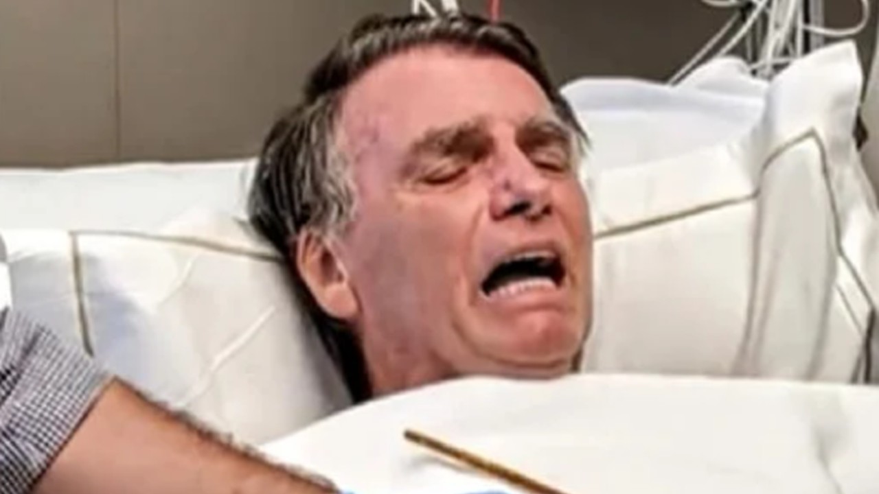 Circo de horrores na "UTI da Fuleragem": Bolsonaro posta remoção de sonda