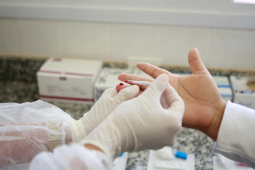 Ministério da Saúde realiza oficina sobre eliminação da Aids e do HIV no Piauí