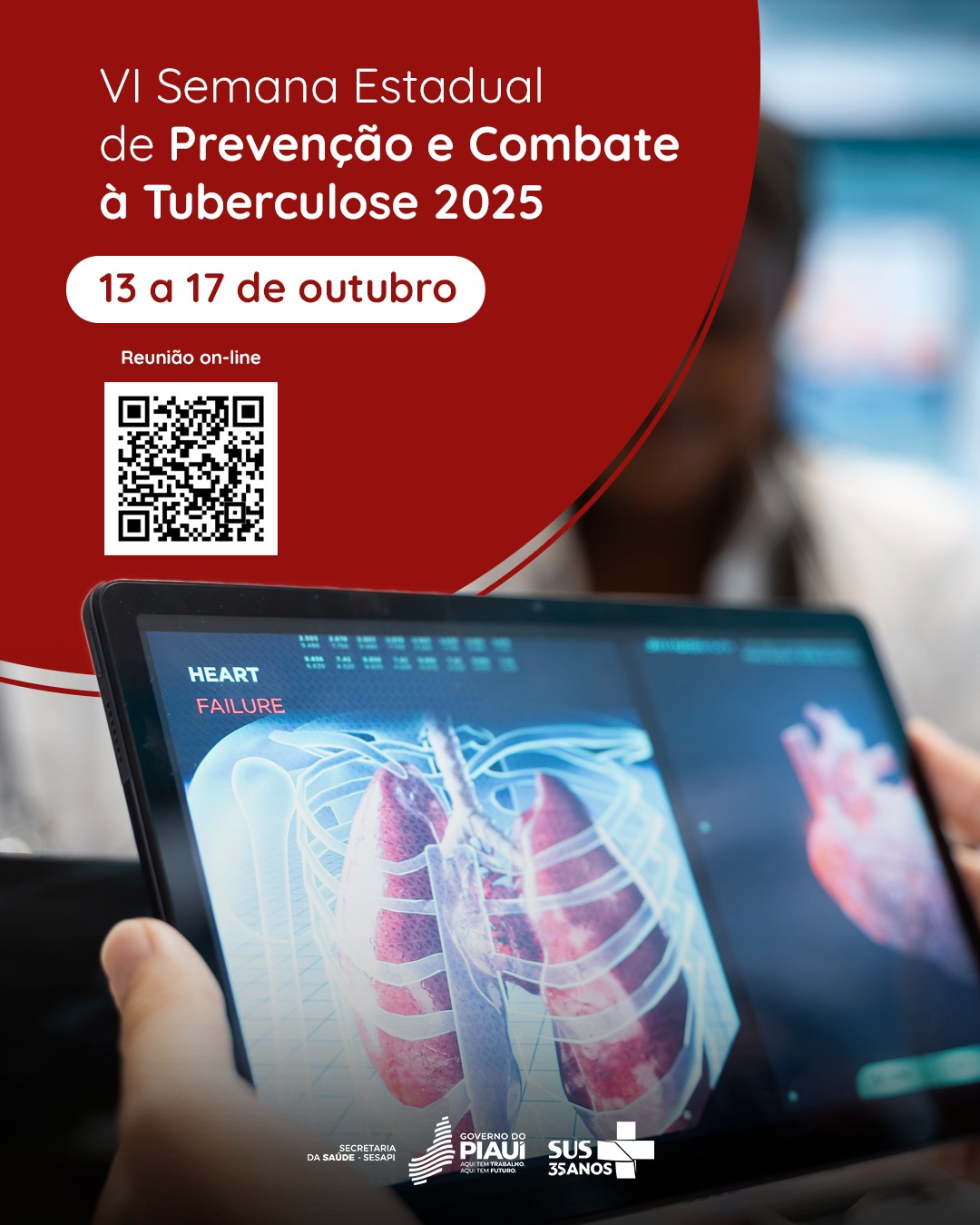 Sesapi realiza VI Semana Estadual de Prevenção e Combate à Tuberculose com foco em diagnóstico e tratamento