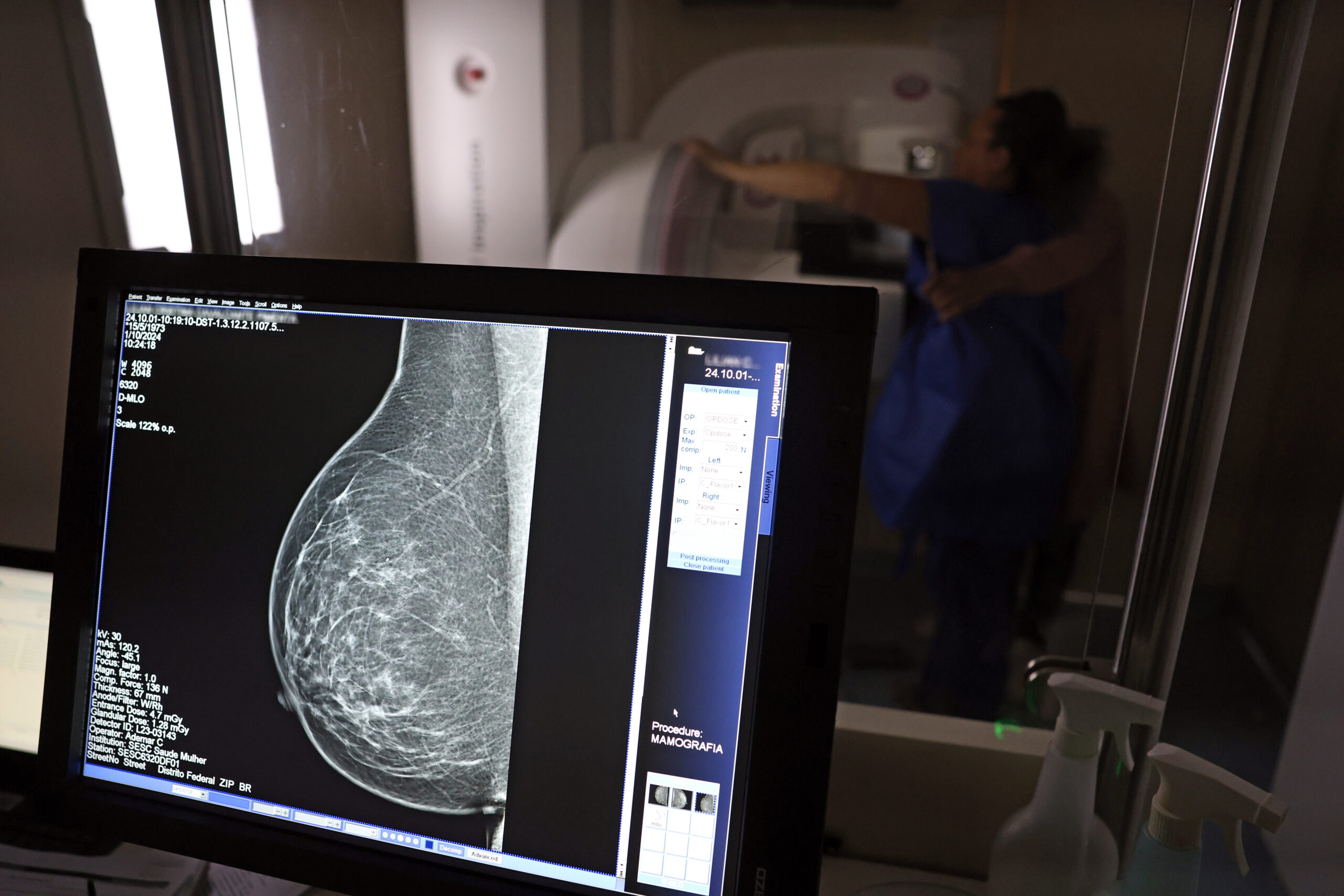 Outubro Rosa: Iaspi libera coparticipação da mamografia durante todo este mês
