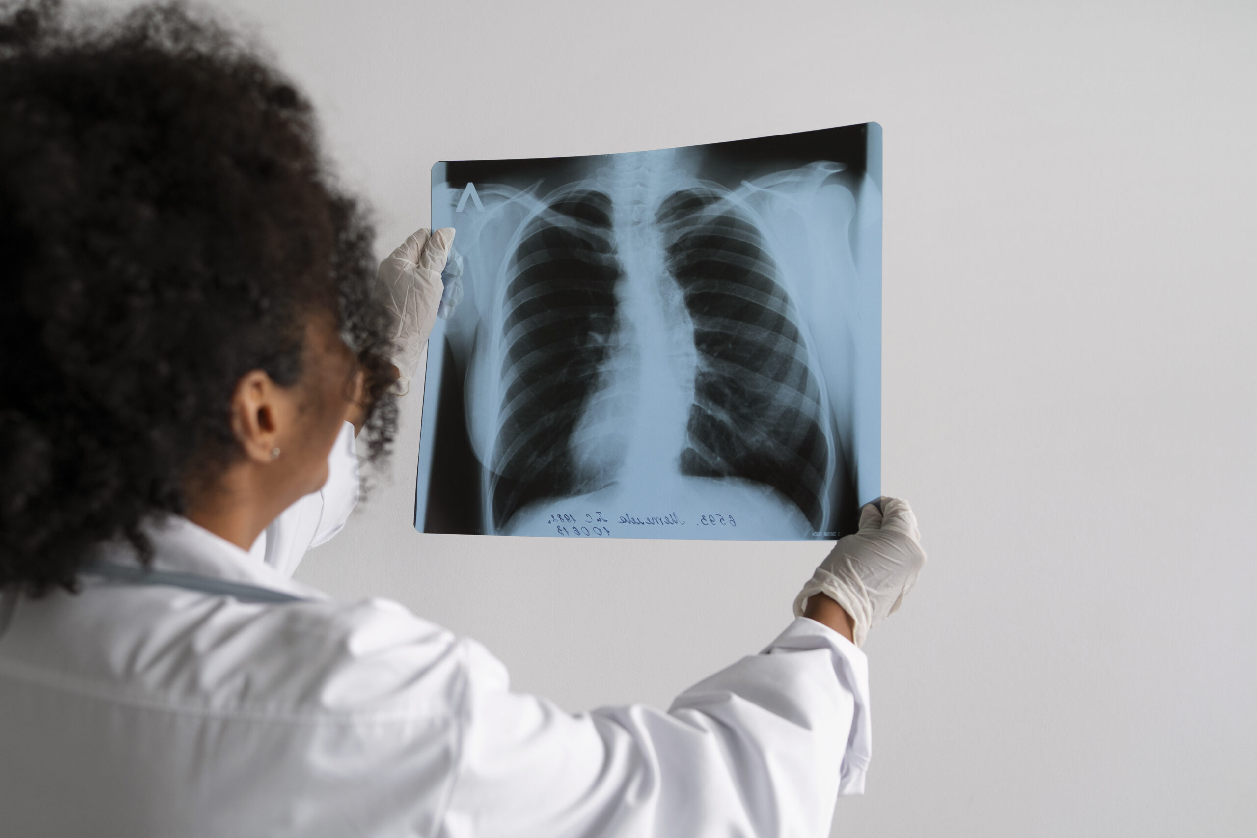 Pesquisa analisa custos do tratamento da tuberculose durante semana de prevenção no estado