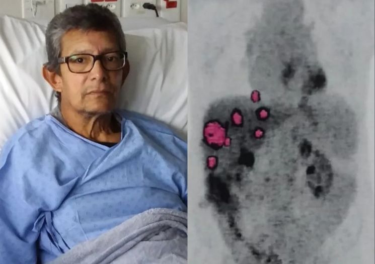 Homem recebe fígado com câncer e descobre metástase