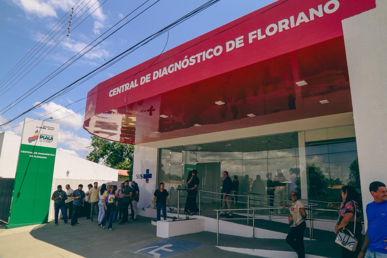 Central de Diagnóstico do Hospital Regional Tibério Nunes ampliará atendimento para até 8 mil exames mensais em Floriano