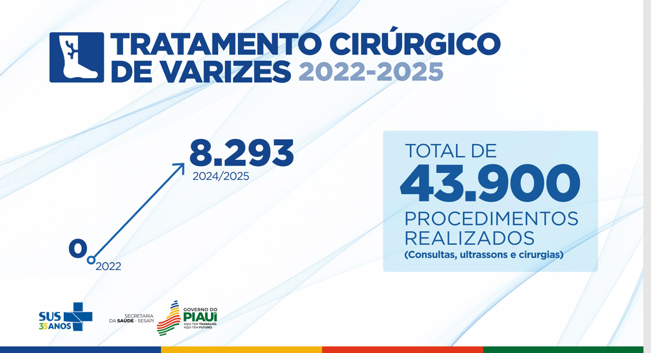 Piauí registra avanço histórico no tratamento cirúrgico de varizes e amplia acesso à saúde vascular