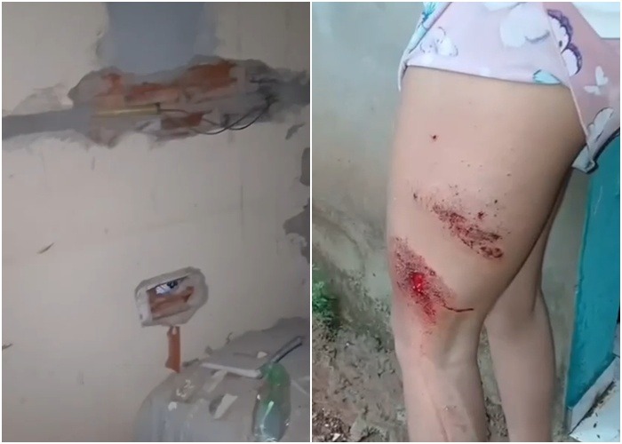 Mulher é atingida por raio durante chuva em Buriti dos Lopes