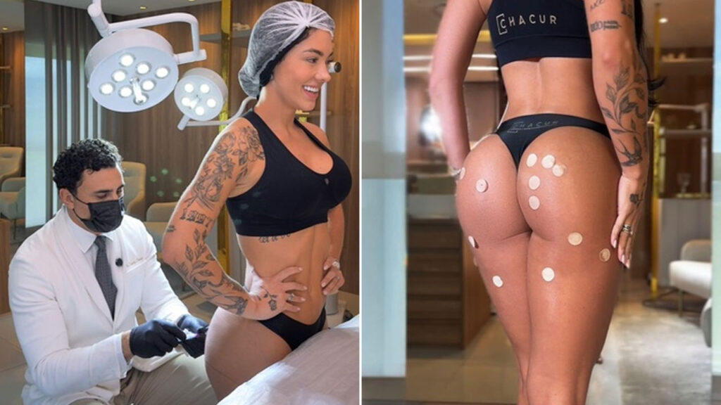 Rayane Figliuzzi e seu Segredo de Beleza: Médico é o 'Segundo Dono'