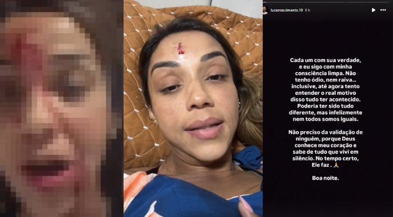 Cantora denuncia relação abusiva e agressão do ex-companheiro