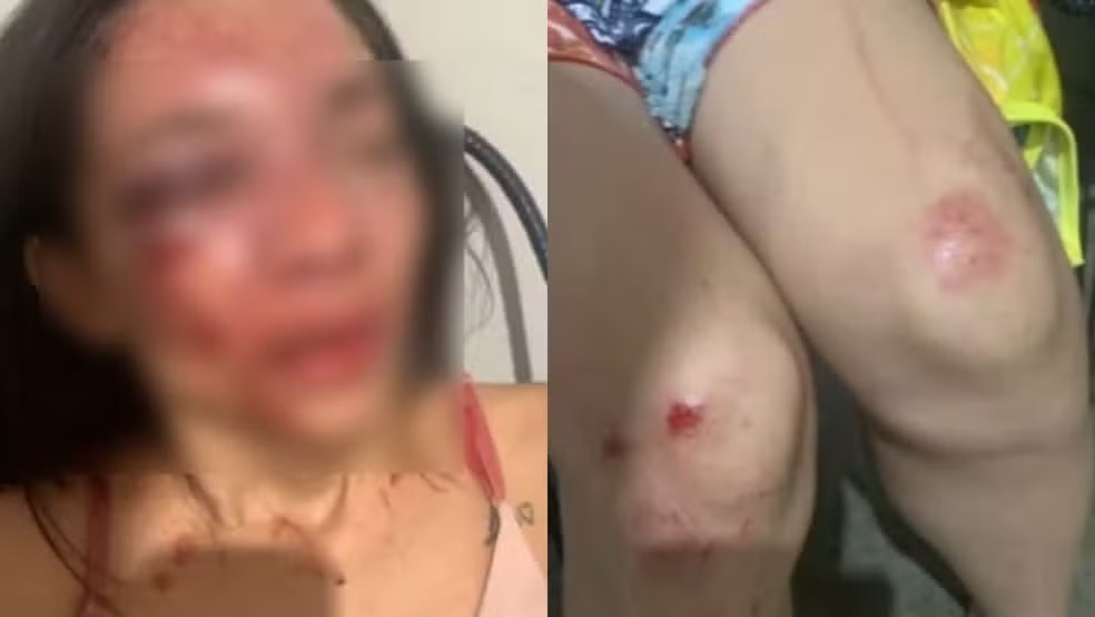 VÍDEO: Mulher denuncia ter sido agredida com socos pelo companheiro no Piauí