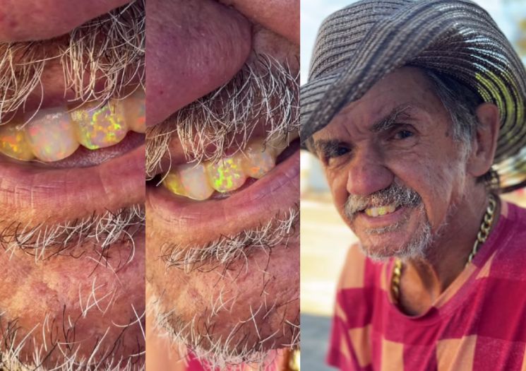 Garimpeiro de Pedro II viraliza ao exibir dentes de opalas